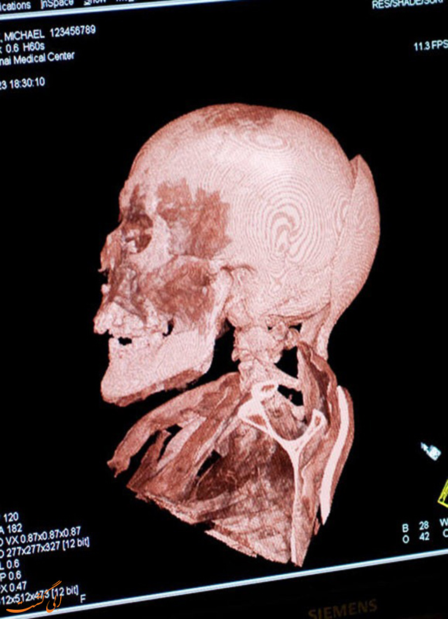 سی تی اسکن مومیایی