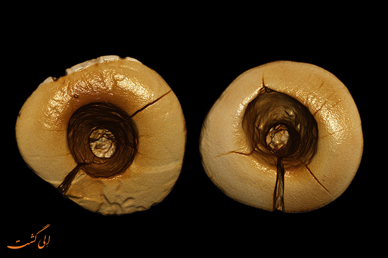 قدیمی ترین دندان پر شده دنیا ایتالیا